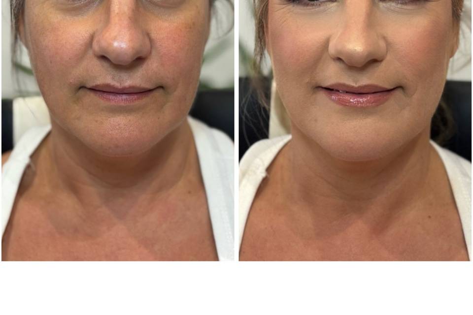Antes y después